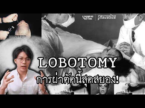 Lobotomy การผ่าตัดนี้ สุดสยอง l รูหนอน...ย้อนนนนน