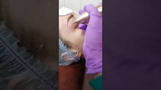 06 PLASMA PEN (ПЛАЗМА ПЕН) ОБУЧЕНИЕ МОСКВА - Курс ведет Врач дерматолог-косметолог Хуснутдинова Н.В. 06 PLASMA PEN (ПЛАЗМА ПЕН) ОБУЧЕНИЕ МОСКВА - Курс ведет Врач дерматолог-косметолог Хуснутдинова Н.В.