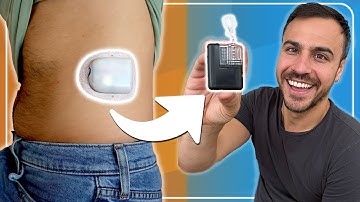 I Switched From Omnipod to Mobi – Here