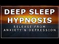 Sleep Hypnosis ~Release From Anxiety And Depression~  ⚡Very Strong⚡