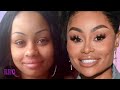 The REAL Reason Blac Chyna is Removing Her Plastic Surgery