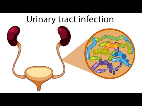 Video: UTI-problem Och Urinblåsinfektioner Hos Kaniner