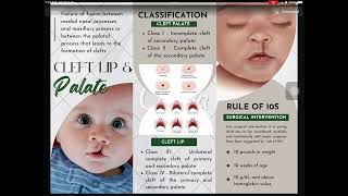 E2 CLITAR, MACARIOLA Interdisciplinary Treatment on Cleft Lip and Palate patients.