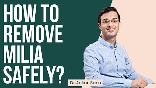 All about milia and how to remove Milia safely at home | Dr. Ankur Sarin