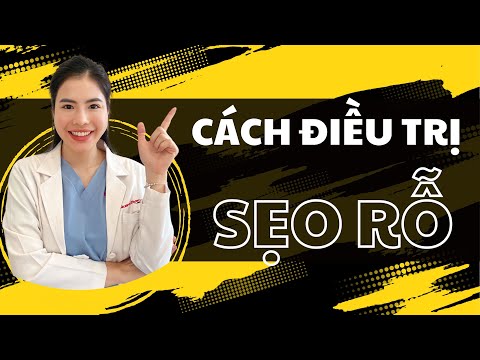 Cách điều trị