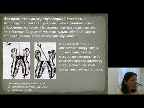 Местное обезболивание 2.Дополнительные методы местного обезболивания Местное обезболивание 2.Дополнительные методы местного обезболивания