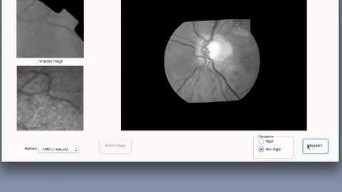 Multi-Modal Retinal Image Registration