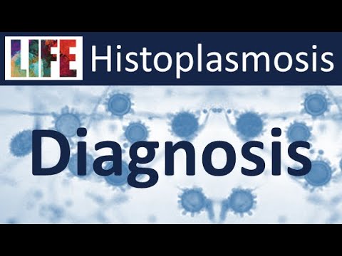 Histoplasmosis epidemiology & diagnosis