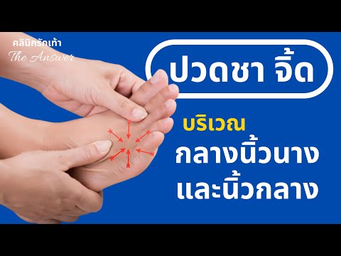 (ตอนที่ 111) ปวดชาๆ ปวดจิ้ดๆ ที่หน้าเท้าบริเวณนิ้วกลางและนิ้วนาง - Morton's Neuroma