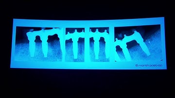 V Story Presentation