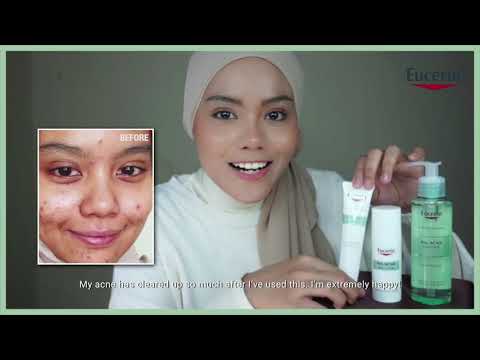 Clear Your Acne Effectively with Eucerin ProACNE Solution