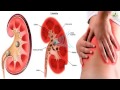 Piedras en los riñones, síntomas - YouTube