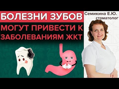 СТОМАТОЛОГИЯ И ЗАБОЛЕВАНИЯ ЖКТ | В чём связь?