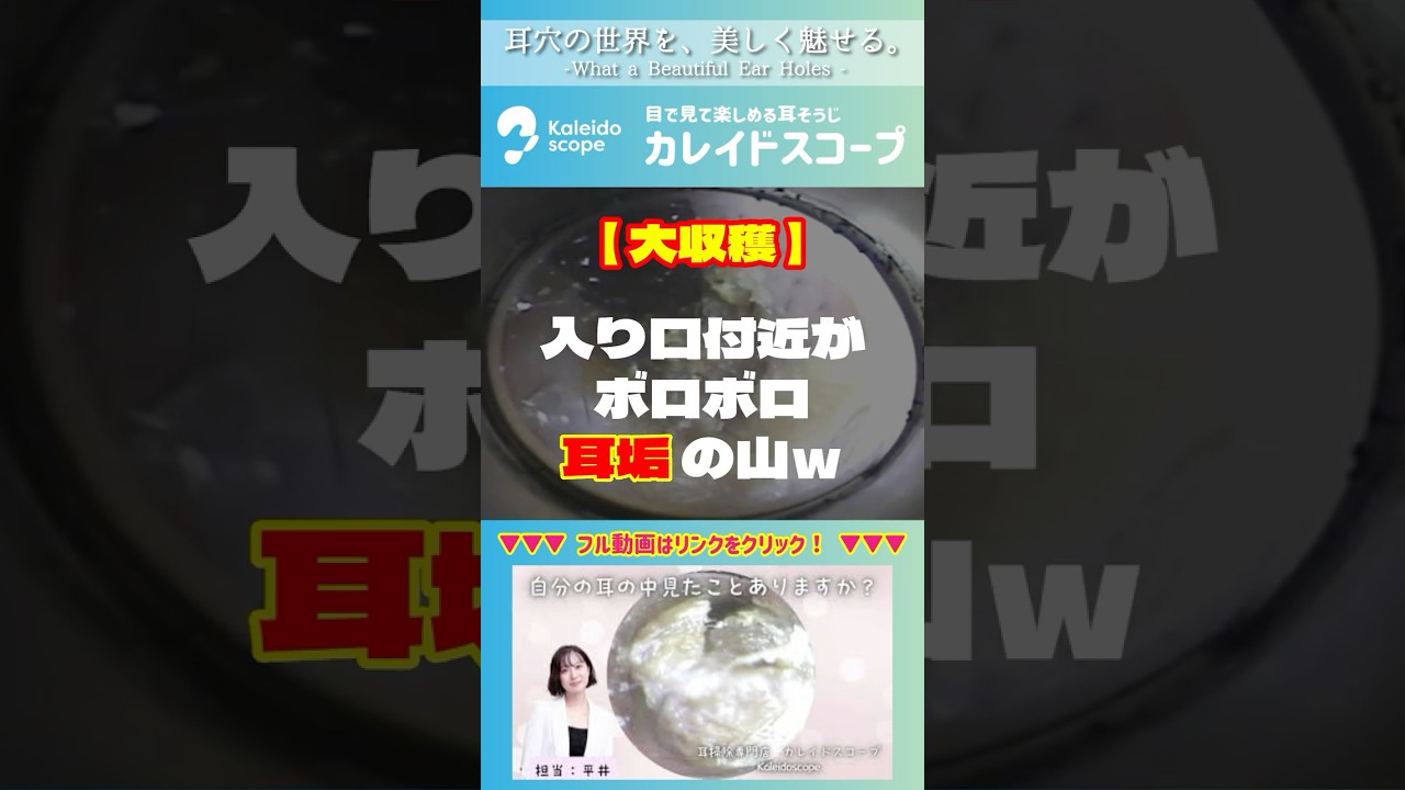 【大収穫】入り口付近がボロボロ耳垢の山ｗ