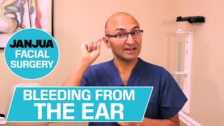 BLEEDING FROM THE EAR - 59 PLUS 1 - DR. TANVEER JANJUA