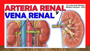 ¿Qué efecto tendría la obstrucción de la arteria renal?