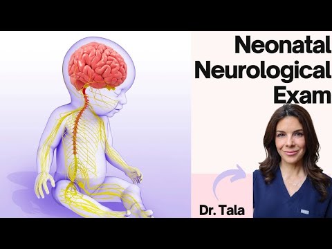 How to perform a neurological exam on a neonate - Tala Talks NICU