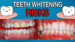 The Risks of Teeth Whitening 