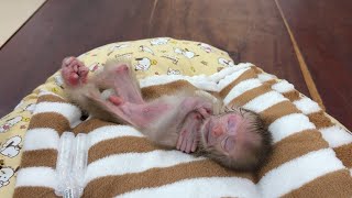 Skinny Poor Newborn Baby Fall A Deeply Sleep After Mom Clean On Sore Eyes