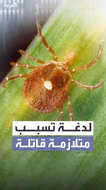    є..      
 - نشر قبل 51 دقيقة