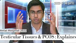Testicular Tissues : Cause of PCOS - Antai Hospitals