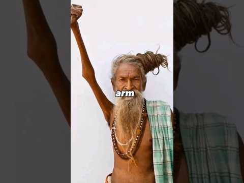 This Man Raised His Arm For Decades Shorts 