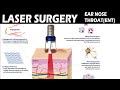 Laser Surgery | Ear Nose And Throat | DR Anjaneyulu | Health And Beauty