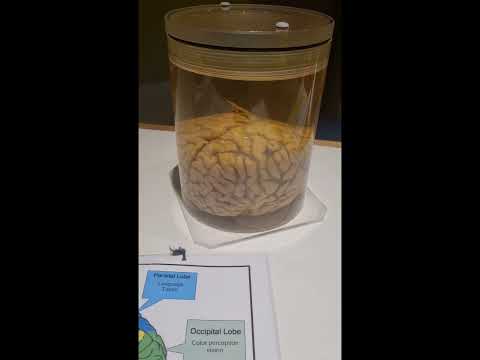 مخ انسان حقيقي سبحان الله حياكم في قناتي     