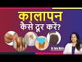 नीचे के कालेपन को कैसे दूर करे ? How to remove Blackness Naturally | Guarantee Result-Dr. Neha Mehta