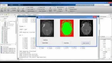 پروژه تقطیع تصویر MR با شبکه عصبی SOM با MATLAB