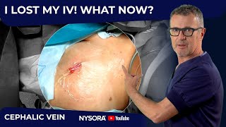 EMERGENT CEPHALIC VEIN CANNULATION TECHNIQUE by NYSORA - Education 30,900 views 3 months ago 5 minutes, 16 seconds