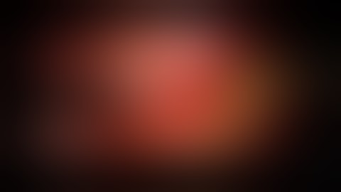 Video-atlas of five robotic-assisted lobectomies - right middle lobectomy