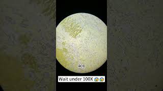 Potato chip fruit magnified 400 times is so cool! #underthemicroscope #microscope #science#shorts