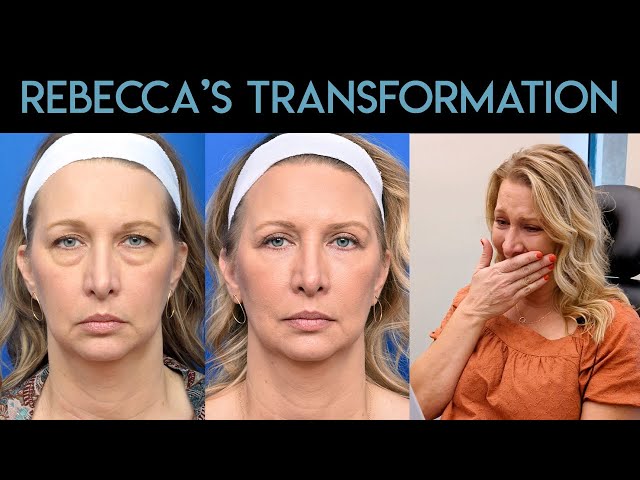 Rebecca's Transformation