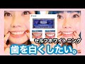 【セルフホワイトニング】歯を白くしたい。3D WHITEが凄すぎた