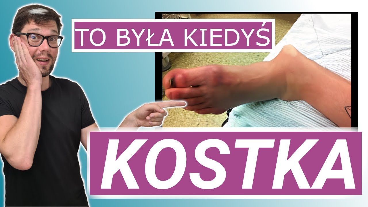 Skręcona Kostka - Leczenie kontuzji PO UPADKU!