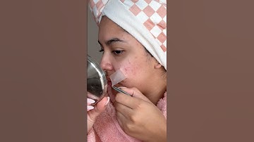 TAKING OFF MY PIMPLE PATCHES 🩵 SATISFYING OR EWWWW? 🩵#beauty #acneskin #grwm #skincare