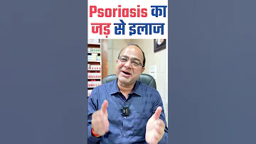 Psoriasis क जड स इल ज Cure Psoriasis With Homeopathy Best Treatment Of Psoriasis 