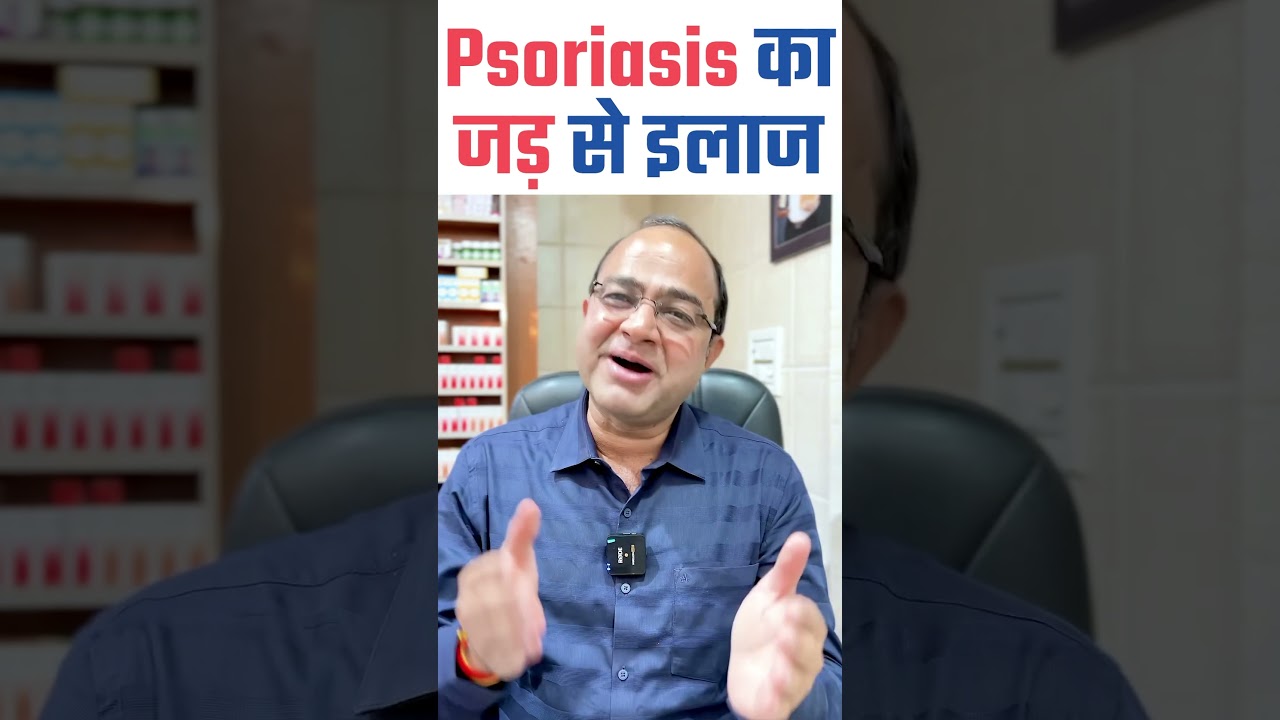 Psoriasis का जड़ से इलाज। Cure Psoriasis With Homeopathy | Best Treatment of Psoriasis