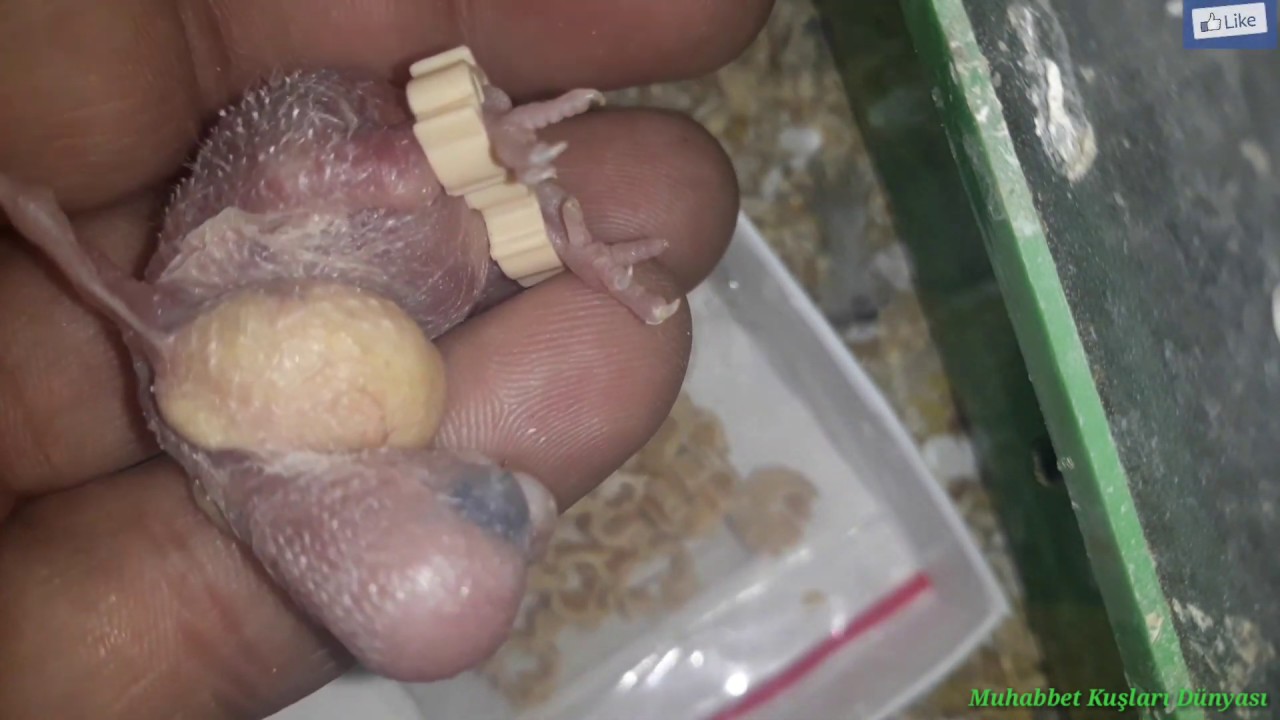 Çarpık Bacak Tedavi Bileziği Nasıl Takılır ?