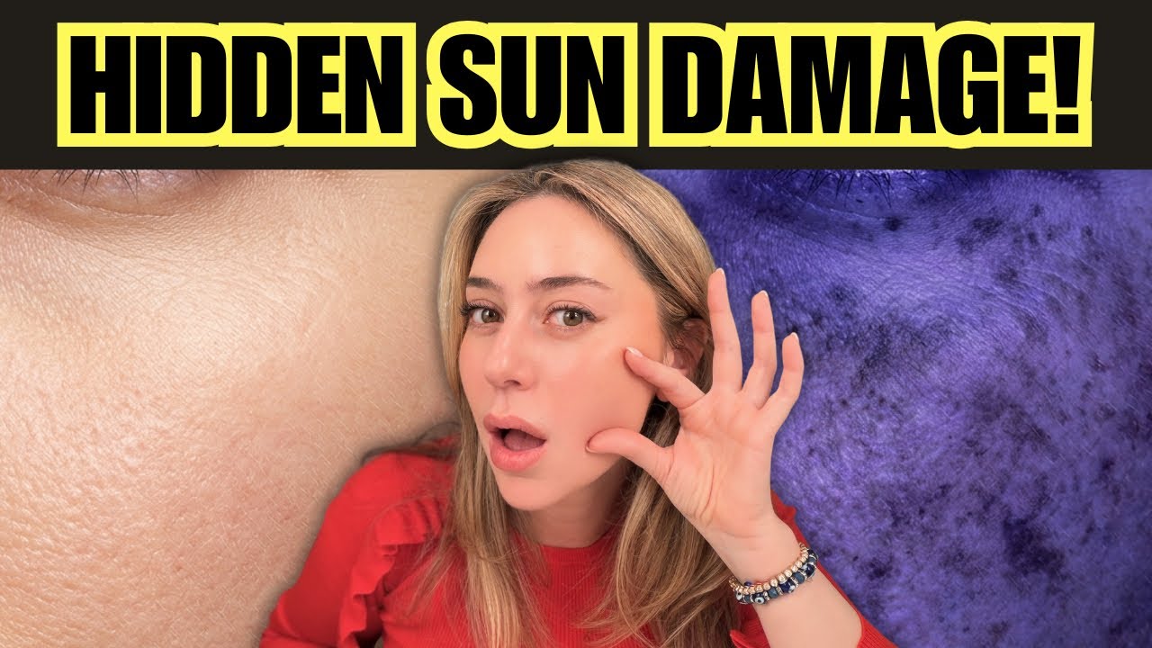 Watch on YouTube: The Truth About Hidden Sun Damage From a Dermatologist | Dr. Shereene Idriss