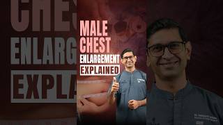 Gynecomastia in Men: Causes & Treatment Options | Célèbre Aesthetics Surat