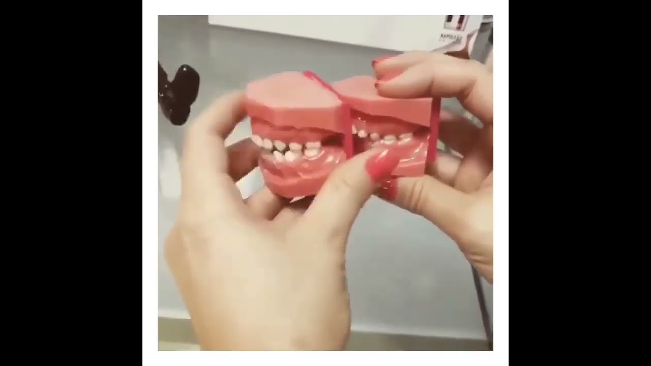 Нарушение прикуса