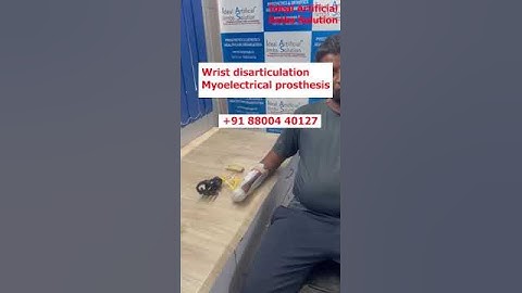 😱Myoelectric Hand | Nakli Hath | Bionic Hand | Best Artificial limb Clinic In Delhi NCR | #ossur