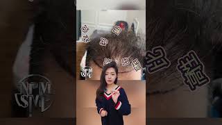 🌸 产后脱发如何解决？NPM纹发技术帮你恢复自然浓密！✨ #女性脱发 #NPM纹发 #scalptattoo #scalpmicropigmentation #hairtattoo #beauty