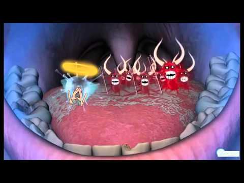 Video: Zubne Bolesti Zamoraca
