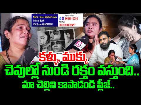 Women Emotional Words About Sister Health Condition | Helping Videos | Pawan Kalyan | Rajahmundry