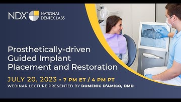 Prosthetically-driven, Guided Implant Placement and Restoration