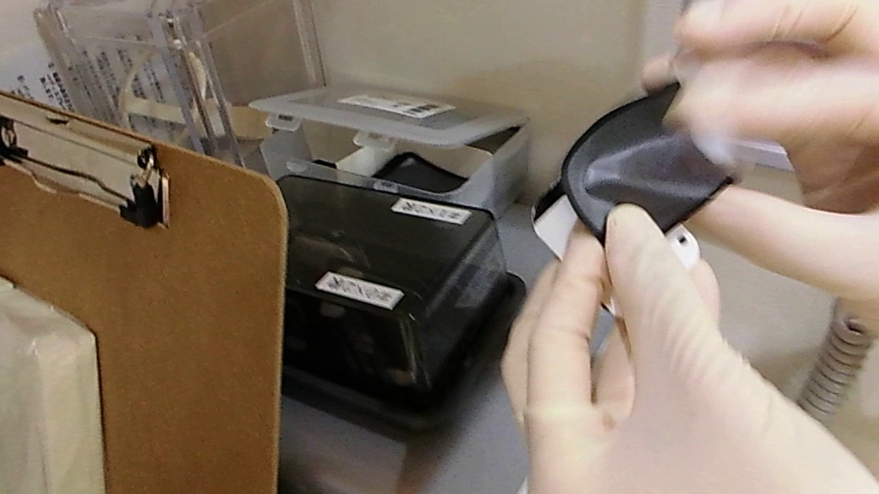 デンタル口翼法のフィルムを読み取る方法