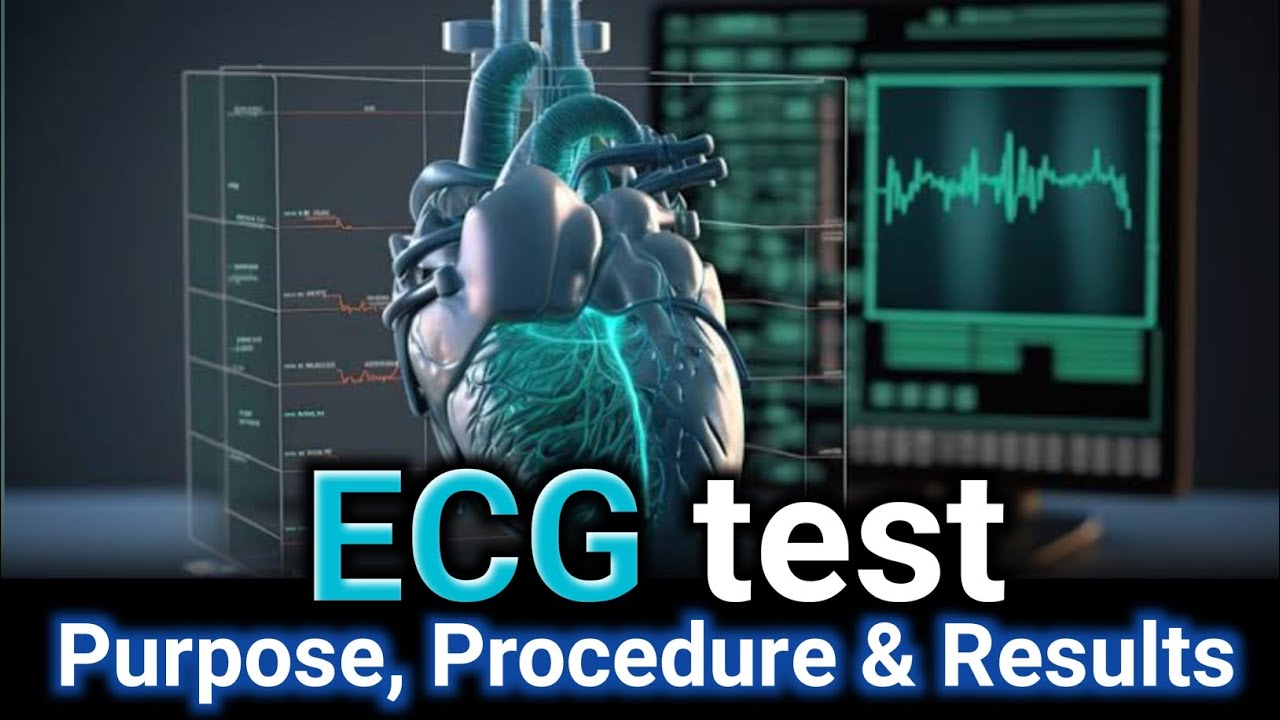 ECG Test Explained: Purpose, Procedure & Results #ecg #medical # ...